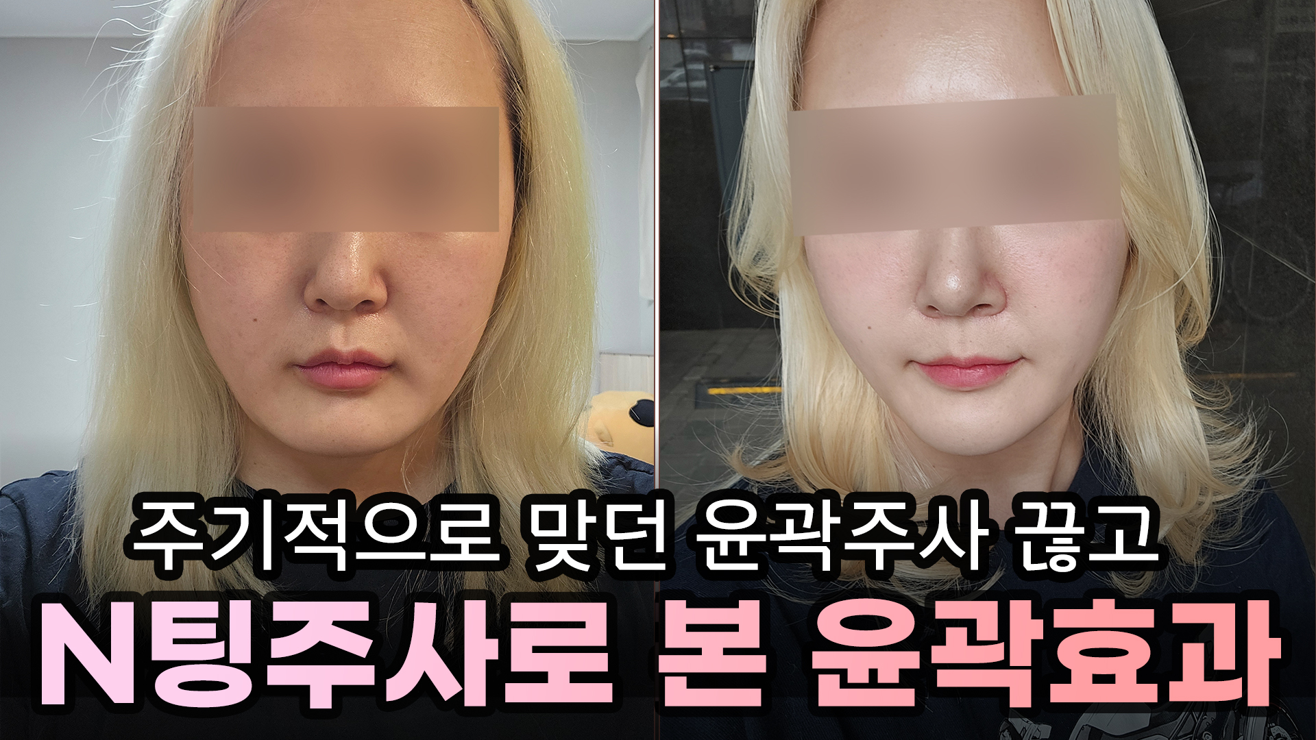 예쁨페이스라인